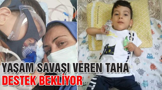 Yaşam Savaşı Veren Taha Destek Bekliyor
