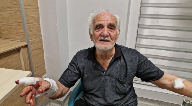 Karaman'da köpek saldırısı, yaşlı adamın eli parçalandı